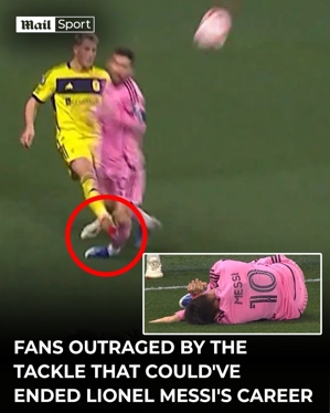 Messi đã bị đá vào bắp chân trong trận đấu và mắt cá chân của anh ấy rõ ràng đã bị biến dạng. Sau khi được bác sĩ của đội điều trị, anh ấy đã trở lại thi đấu.
